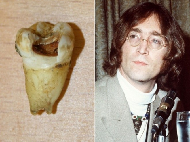 Năm 2011, những chiếc răng của John Lennon được một nha sĩ người Canada mua với giá 31.000 USD để trưng bày trong phòng Shbet888 tiền thưởng cực khủng của mình cũng như đem đi giới thiệu ở các phòng khám nha khoa khác.