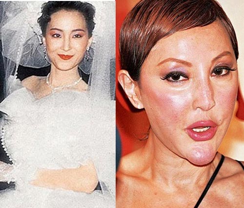 Tuy nhiên nhiều năm sau, người đẹp sa đà vào việc thẩm mỹ khiến dung nhan hiện giờ 'xuống dốc không phanh'.