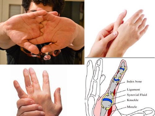 Bẻ khớp - không ít người có thói quen bẻ các khớp ngón tay, ngón chân, khớp cổ hoặc vặn lưng khi mỏi mà không biết rằng, điều này sẽ khiến khớp to lên, xấu về thẩm mỹ.