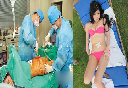 Cận cảnh quá trình thấm mỹ nhiều đau đớn của một người mẫu