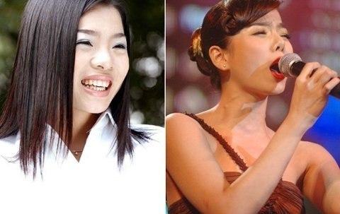 Sự thay đổi của cô sau khi thẩm mỹ.