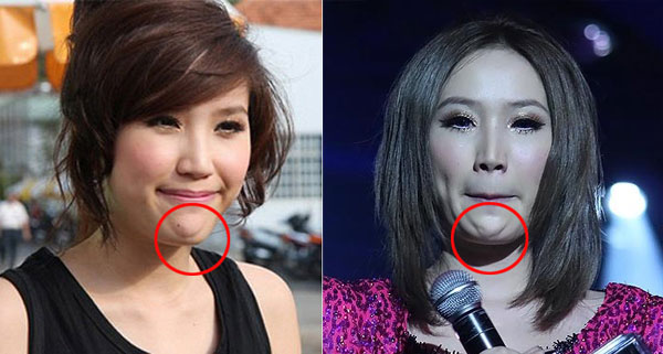 Cùng với đó là những nghi vấn Shbet888 tiền thưởng cực khủng thẩm mỹ khi chiếc cằm của Bảo Thy dần biến dạng.