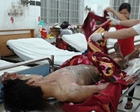 Tẩm xăng đốt vợ ngày thôi nôi con, hai bố con bỏng nặng