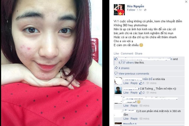 Hình ảnh mới nhất của Hòa Minzy đăng tải trên trang cá nhân với mặt mộc nhiều mụn trứng cá.