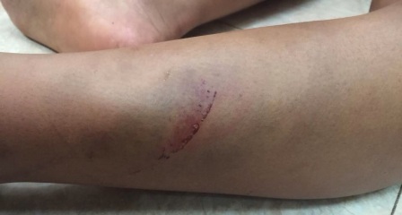 Nghi vấn cha ruột và mẹ kế bạo hành con trai 9 tuổi dã man