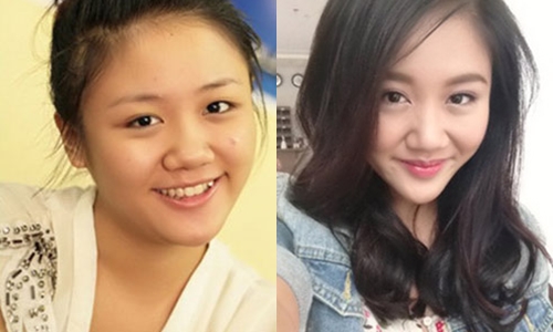 10 người đẹp vướng nghi án độn cằm quá đà