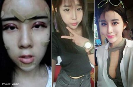 Làn sóng hút mỡ, nâng ngực của thiếu nữ châu Á