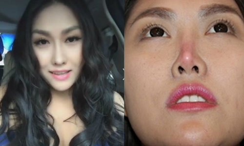 Phi Thanh Vân bỗng dưng trẻ đẹp sau lần 