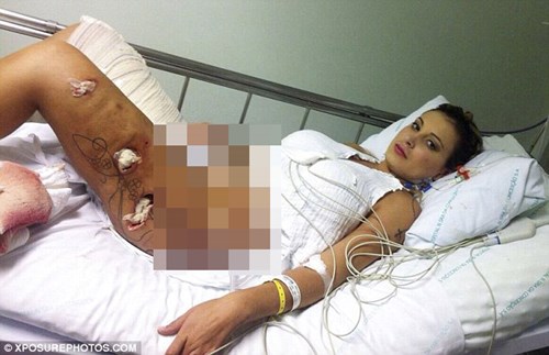 Andressa Urach, á hậu trong một cuộc thi sắc đẹp tại Brazil đã phải nhập việt sau một cuộc Shbet888 tiền thưởng cực khủng thẩm bơm vùng đùi và hông bị hỏng.