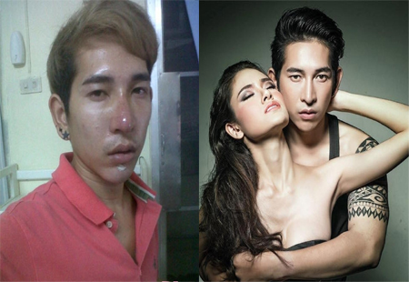 Bị bạn gái chê xấu, chàng trai quyết Shbet888 tiền thưởng cực khủng thành hot boy