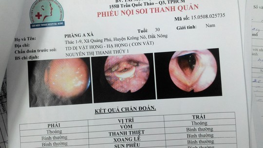 Kinh hoàng: Khạc ra máu do bị đỉa chui vào cuống họng