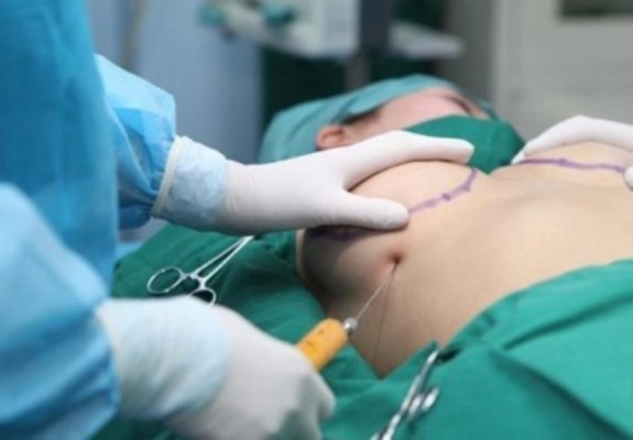 Cách phát hiện phụ nữ nâng ngực