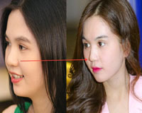 Ngọc Trinh cùng đàn em bị nghi Shbet888 tiền thưởng cực khủng thẩm mỹ