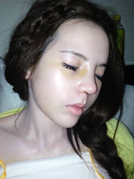 Khuôn mặt sưng phù đau đớn giống như Trương Phương đã tái hiện.