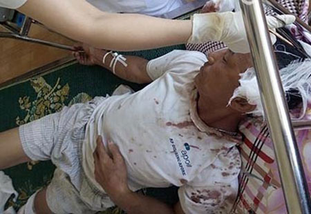 Vụ giang hồ truy sát ông lão: Kẻ chủ mưu là con dâu nạn nhân