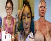 Những tai nạn thẩm mỹ rúng động nhất