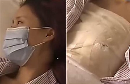 Mất một bên ngực vì Shbet888 tiền thưởng cực khủng vòng một