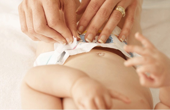 Nhìn nước tiểu đoán sức khỏe của bé