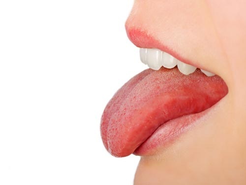 Ung thu lưỡi: Cái chết cận kề không hẹn trước và điều cần biết