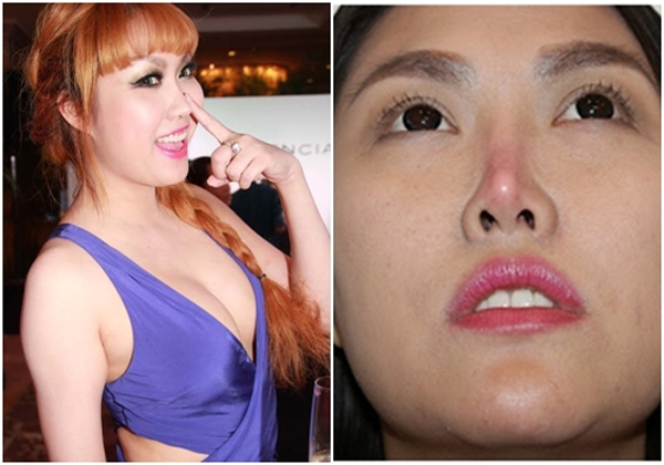 Phi Thanh Vân đang gánh chịu hậu quả Shbet888 tiền thưởng cực khủng thẩm mỹ 10 năm trước ở chiếc mũi.