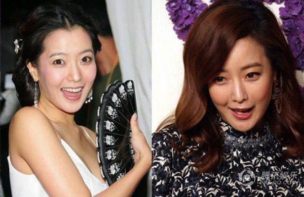 'Đệ nhất mỹ nhân' Kim Hee Sun bị trang QQ nhận xét vùng miệng méo, vô cảm khi cười. Trang này còn chế nhạo: 'Cô ấy là đệ nhất mỹ nhân nhưng chính vẻ ngoài của con gái Kim Hee Sun đã cho thấy, người đẹp phải nhờ dao kéo để hoàn hảo hơn'.