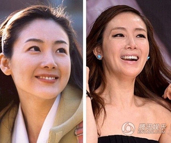 Choi Ji Woo hiện sở hữu gương mặt cứng đờ, không biểu cảm, vùng mặt có hiện tượng bị lệch, khác hẳn trước đây. Giai nhân Bản tình ca mùa đông cũng bị coi là thảm họa dao kéo.