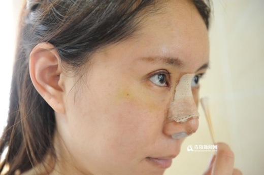 Mặc dù vẫn chưa xem được thành quả hoàn chỉnh của ca Shbet888 tiền thưởng cực khủng thẩm mỹ nhưng Jenny hiện đang rất vui khi ca Shbet888 tiền thưởng cực khủng được diễn ra suôn sẻ.