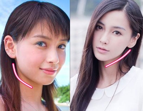 Xương gò má gọn hơn. Cô mang đẹp đúng chuẩn của xu hướng hiện nay.