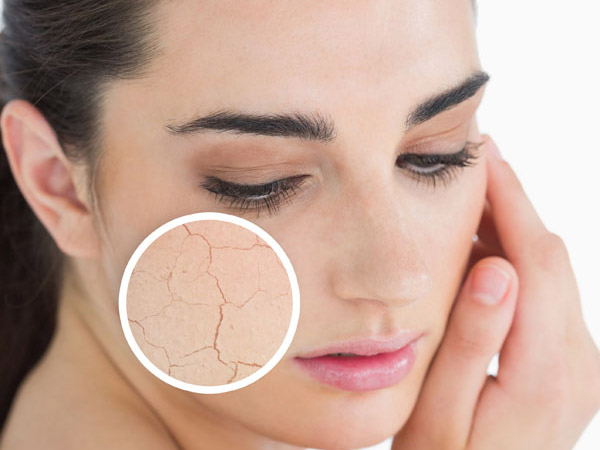 Thói quen phổ biến vào mùa đông khiến da bạn luôn tróc vảy