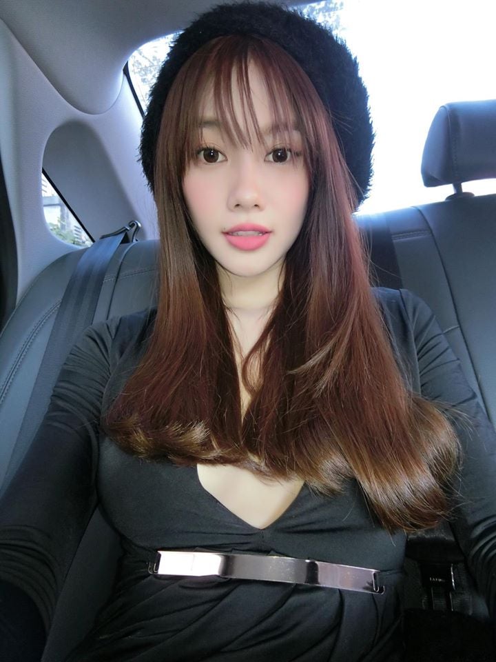 Linh Chi tiếp tục bị \'ném đá\' bởi gương mặt cứng đơ cùng vòng một bất thường.