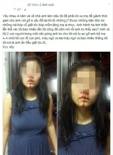 Xót xa người vợ tố chồng bạo hành dã man, nhà chồng hắt hủi