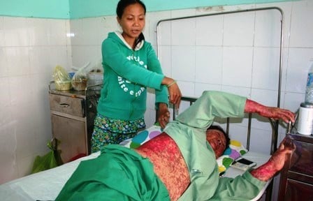 Cẩn thận 