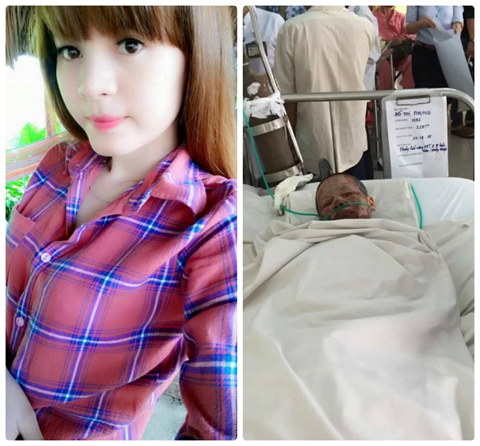 Cô gái nghèo xinh đẹp bị hủy hoại nhan sắc vì gã trai cuồng yêu