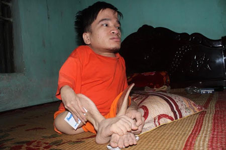 Bị cha hành hạ, người con khuyết tật viết thư máu xin về ở với mẹ