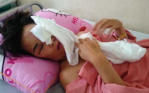 Người phụ nữ bị tạt axit khi chở con đi học: Chồng cũ là chủ mưu