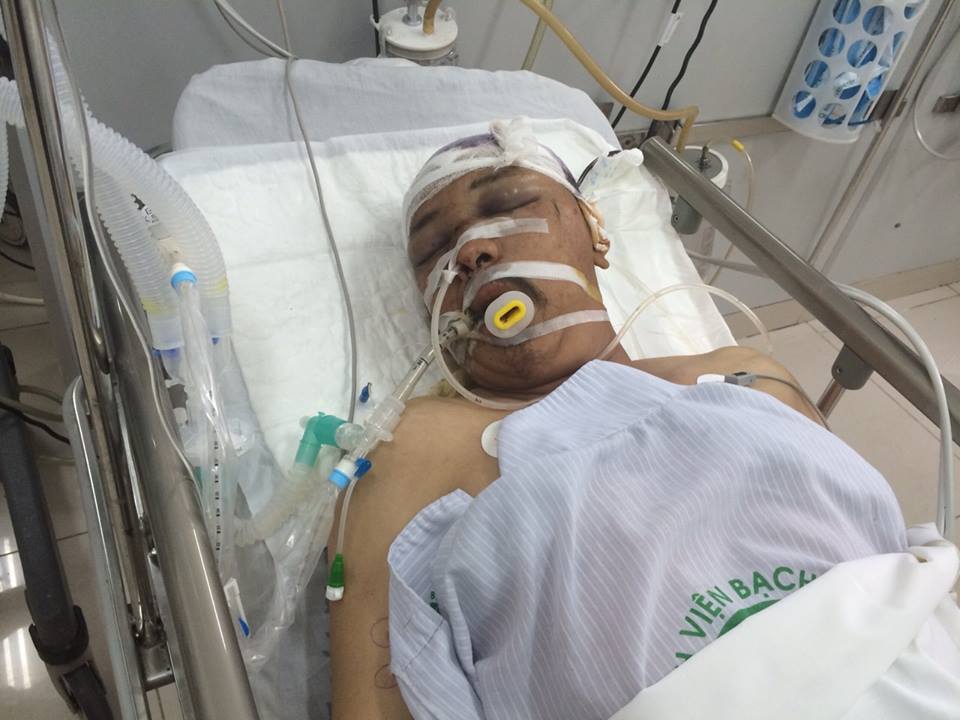 Tìm người nhà bệnh nhân đang nguy kịch