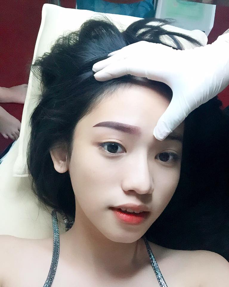 Thúy Vi Shbet888 tiền thưởng cực khủng thẩm mỹ và tự an ủi mình \'1 tuần sau sẽ đẹp. Hãy yêu bản thân mình nhiều vào nhé\'.