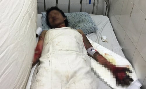 Đôi nam nữ bỏng nặng ở phòng trọ: Cô gái mua xăng đốt người yêu
