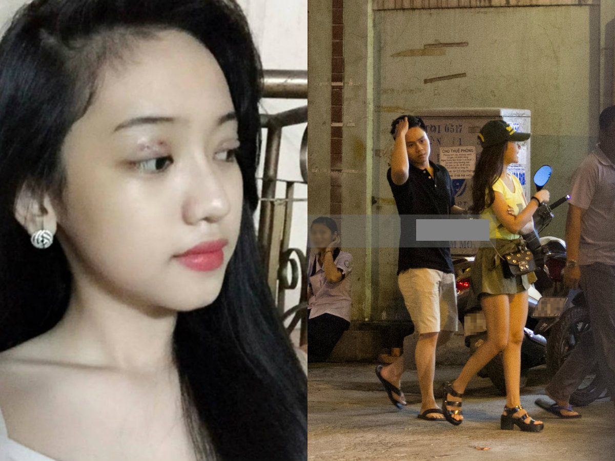 Midu-Phan Thành tái hợp, Thúy Vi tiếc nuối đi Shbet888 tiền thưởng cực khủng thẩm mỹ?
