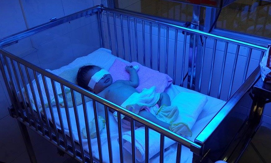 Bé 2 ngày tuổi bị mẹ cắn cụt đốt ngón tay