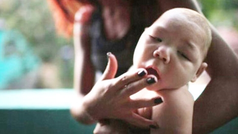 Virus Zika -