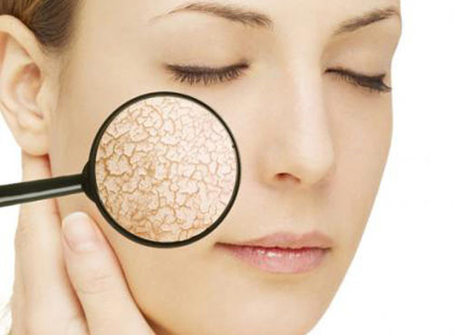Nhận biết ngay khi Mừng SHBET phiên bản mới 2025 của bạn bị thiếu độ ẩm nghiêm trọng