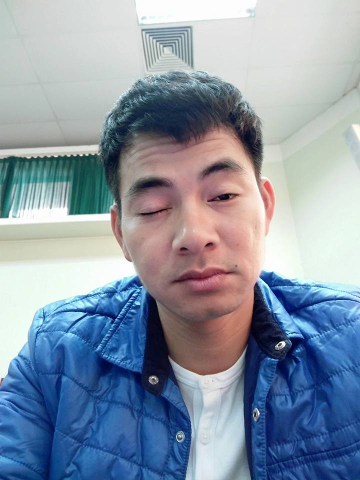 Xuân Bắc đặt câu hỏi khó \'Có ai thèm ngủ quanh năm như tôi không nhở?\'.