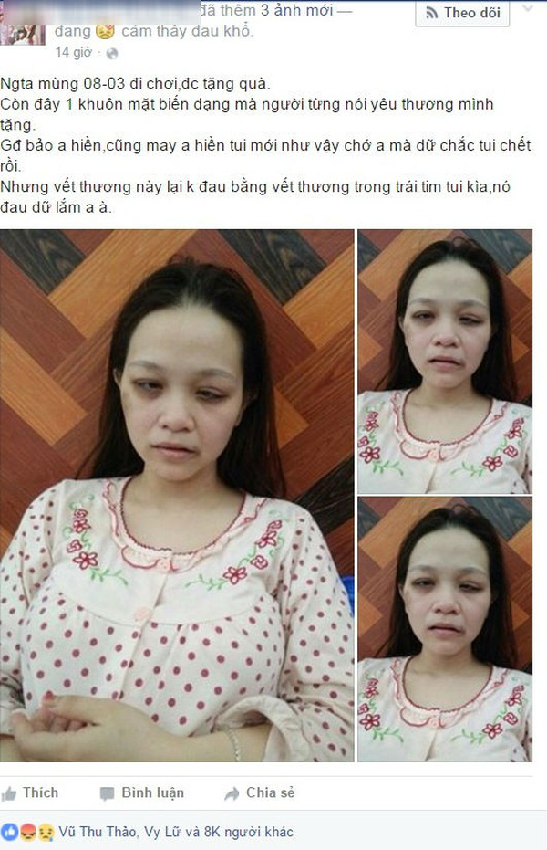 Người vợ trẻ đang ở cữ bị chồng đánh dã man ngay trước 8/3