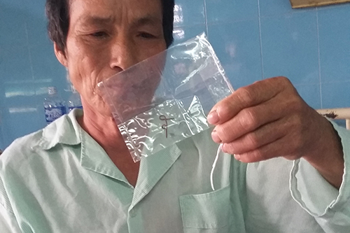 Sốc với sợi dây đồng 4cm nằm trong phế quản cụ ông 60 tuổi
