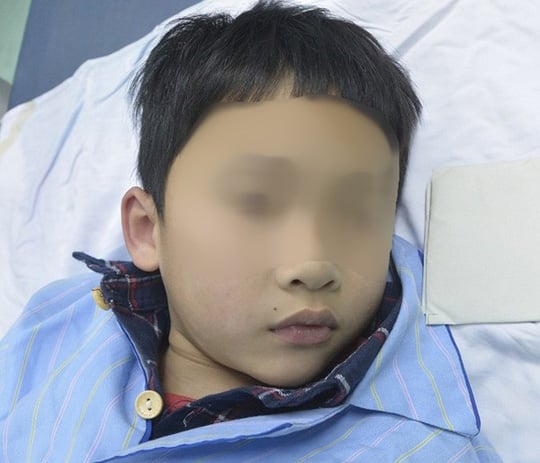 Đầu bút bi dài 1cm nằm trong phế quản bé trai 7 tuổi