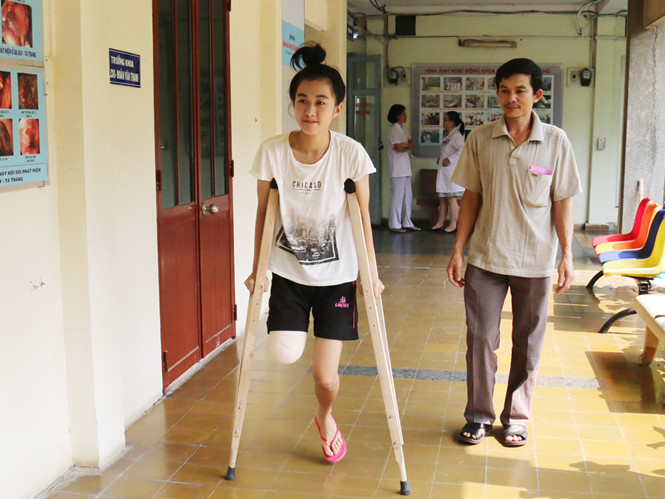 Nữ sinh bị cưa chân đã bắt đầu tập đi bằng nạng gỗ