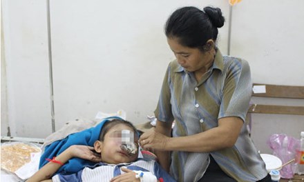 Xót thương bé trai 12 tuổi bị ăn mòn khuôn mặt vì bệnh lạ