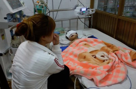Bé gái 25 tháng tuổi ngã dập não hiện rất nguy kịch