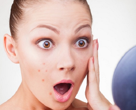 Mẹo làm mát Sh88bet đăng ký miễn phí để không mọc mụn trứng cá